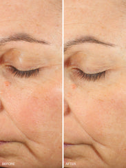 Active Collagen Wonder Serum Refill