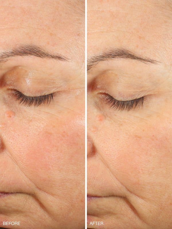 Active Collagen Wonder Serum Refill