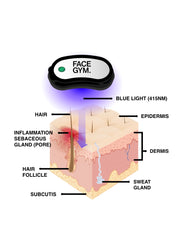 Acne Light Shot Scientific diagram showing how Blue Light  Therapy can reach deep into your Dermis
