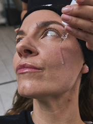 RESURFACING PEEL