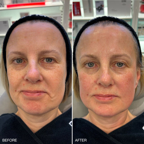 customer before and after a facegym workout